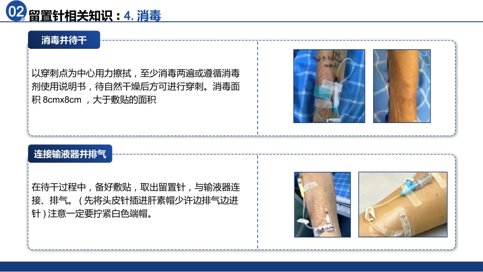静脉留置针的应用于维护_第13页