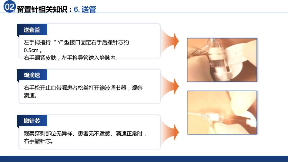 静脉留置针的应用于维护_第15页