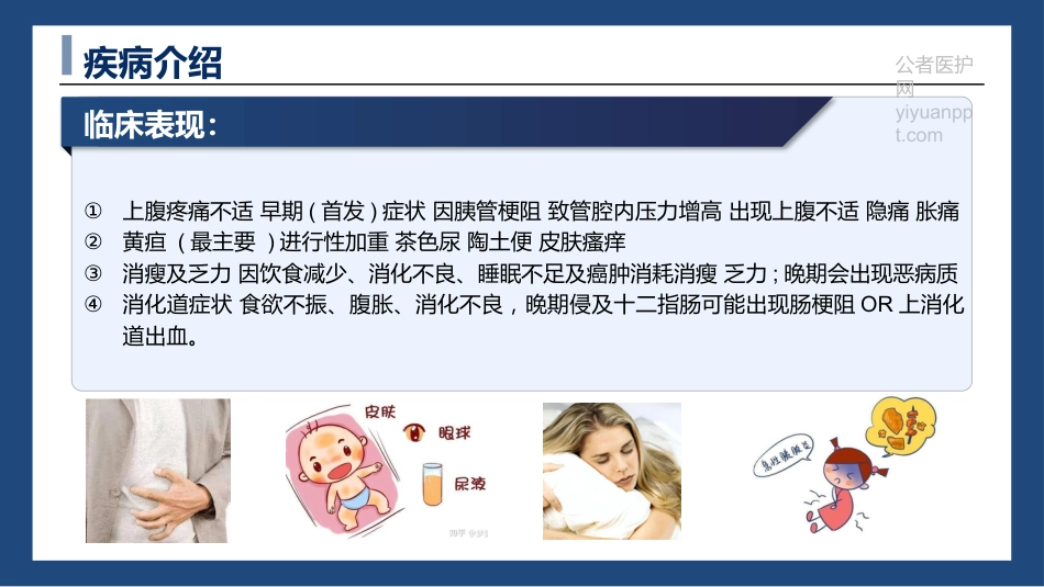 胰腺癌患者护理查房-癌症之王_第11页