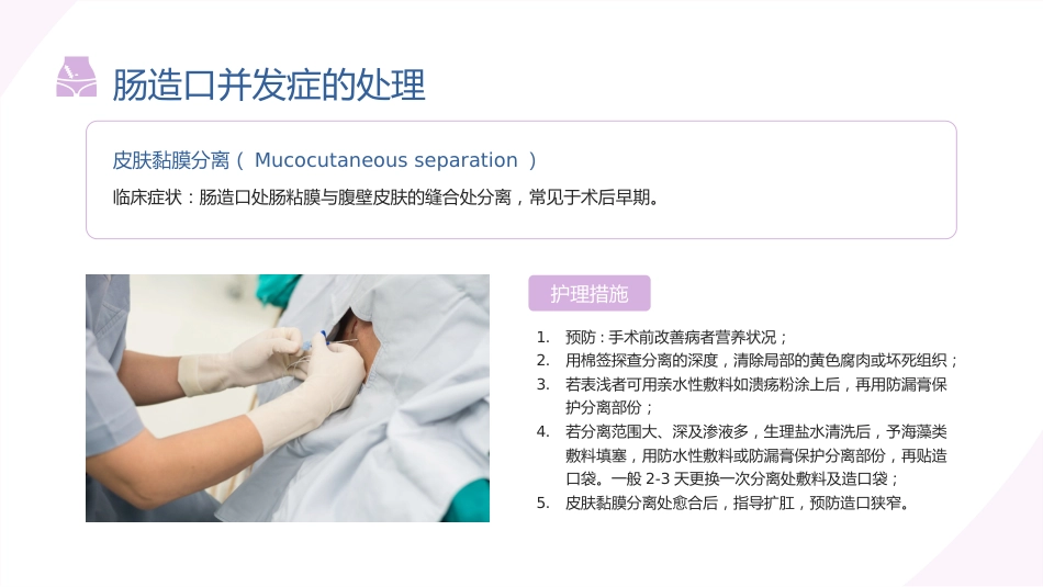 伤口造口术后护理ppt_第14页