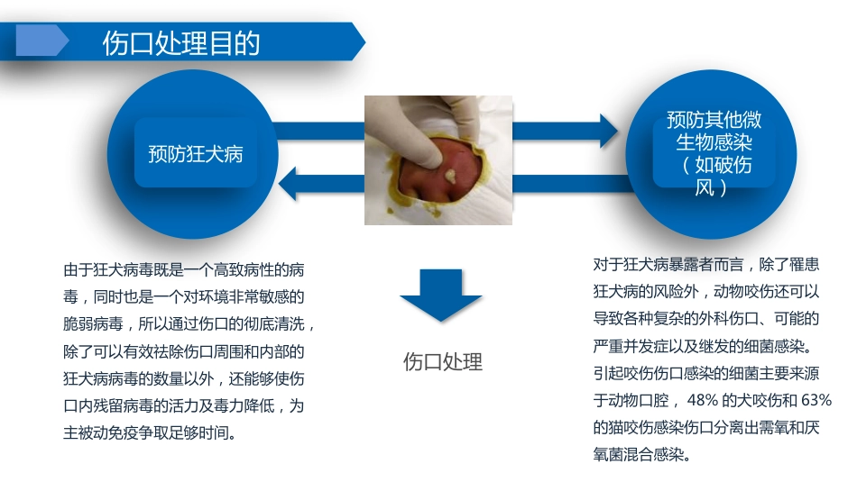 狂犬病及破伤风规范预防_第15页