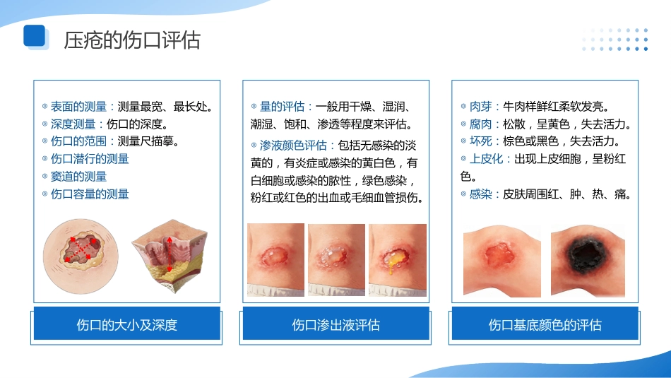 压疮的预防与护理讲座_第13页
