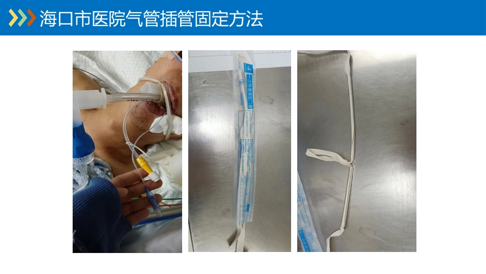 重症专科护士学习汇报_第15页