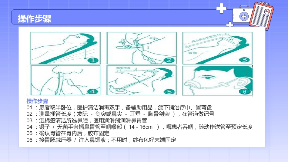 留置胃管的护理_第11页