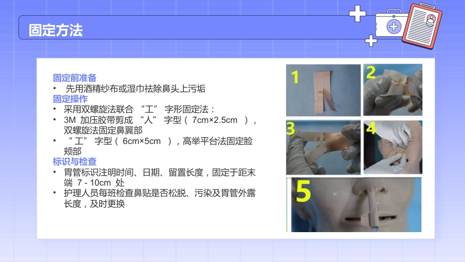 留置胃管的护理_第14页
