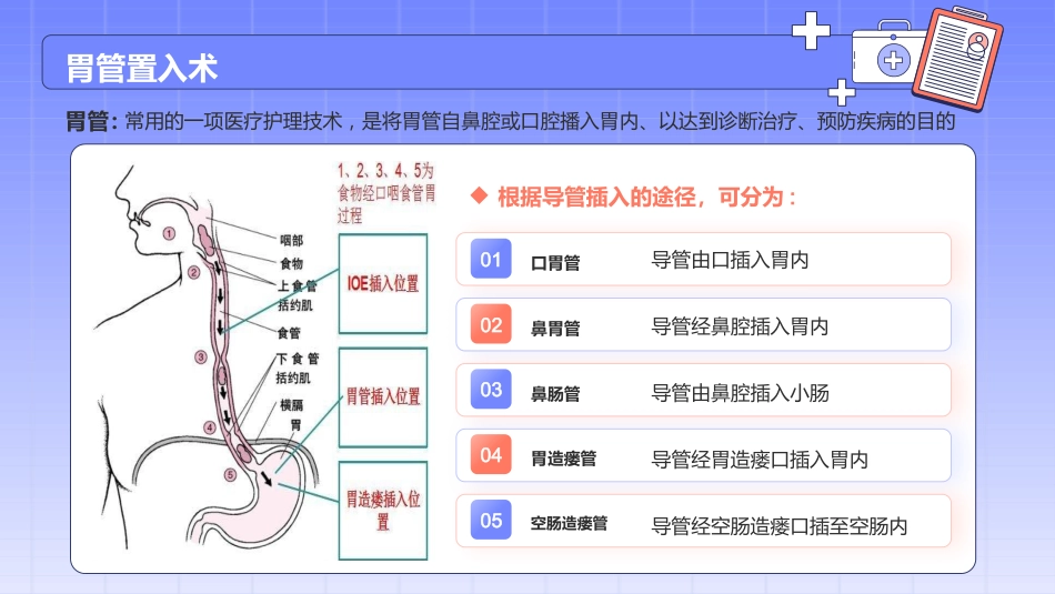 留置胃管的护理_第4页