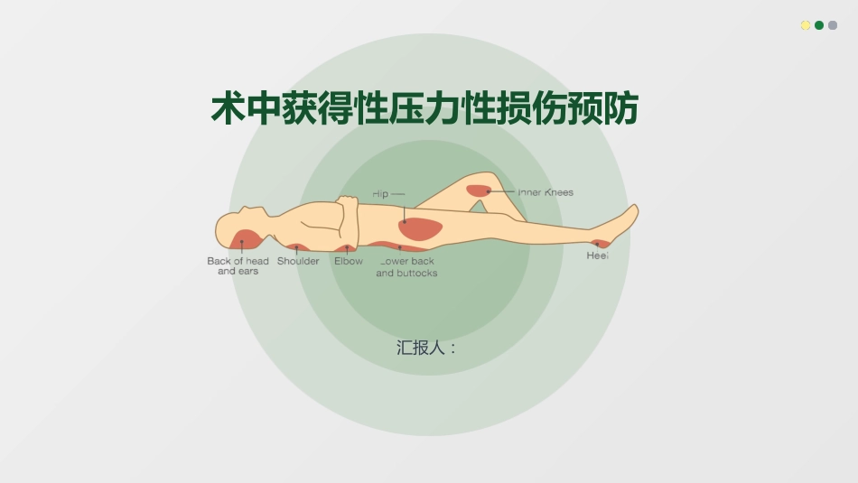 术中获得性压力性损伤预防_第1页