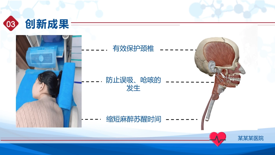 内镜麻醉检查护理创新大赛汇报_第13页