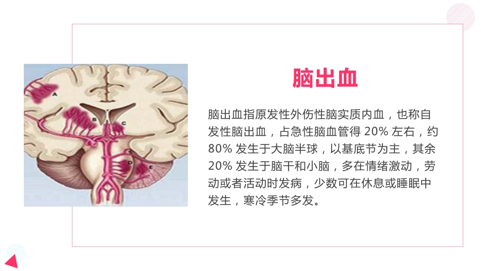 脑出血教学查房_第4页