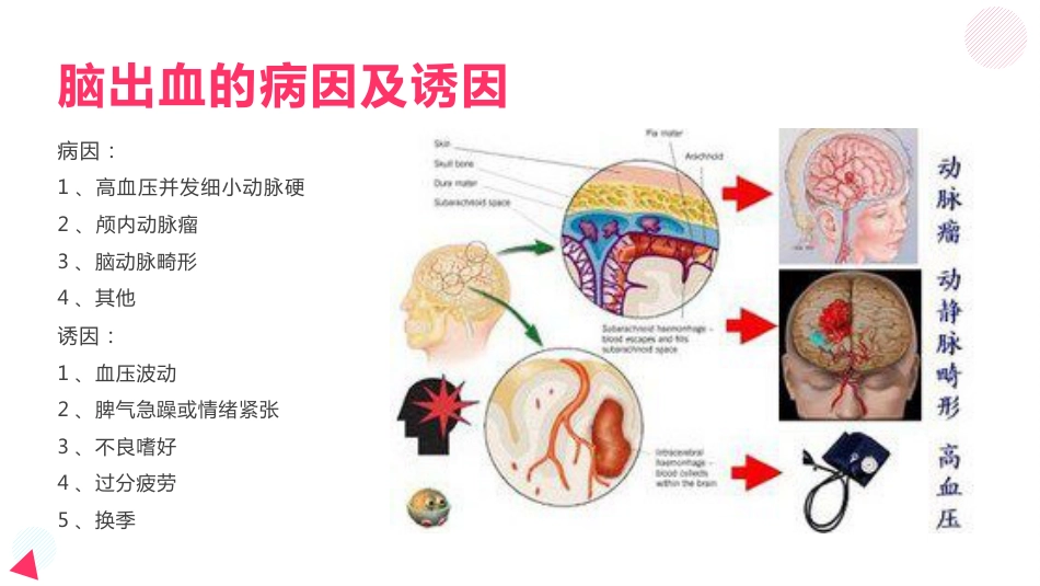 脑出血教学查房_第6页