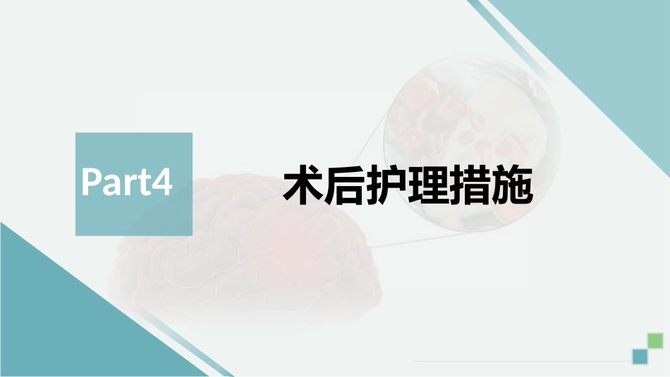 脑血管造影及支架植入术后护理_第13页