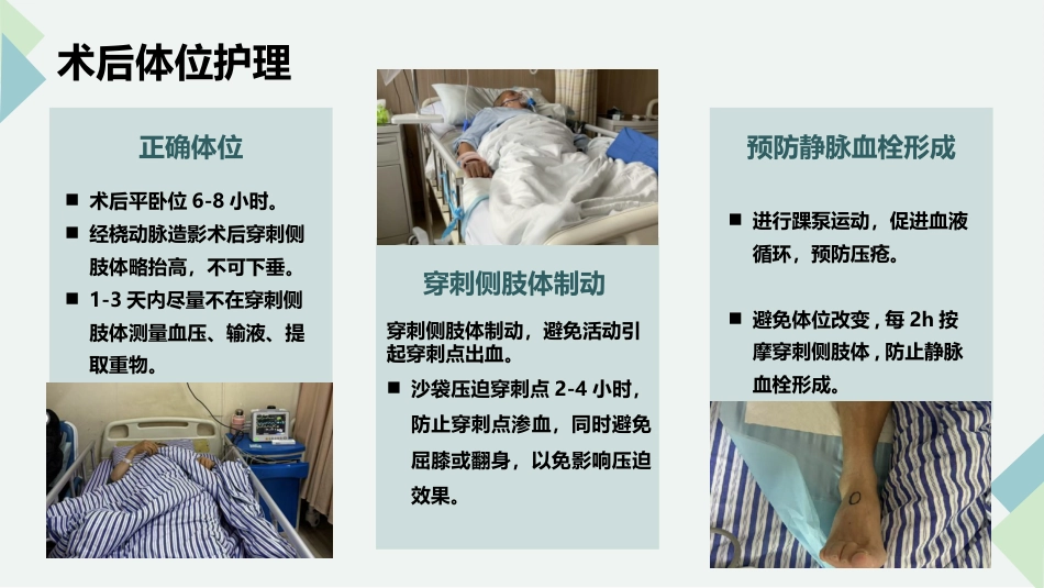 脑血管造影及支架植入术后护理_第14页