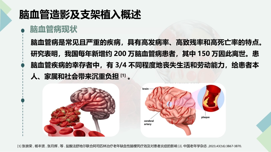 脑血管造影及支架植入术后护理_第4页