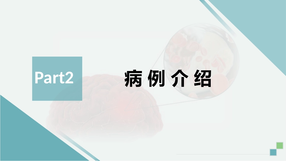 脑血管造影及支架植入术后护理_第7页