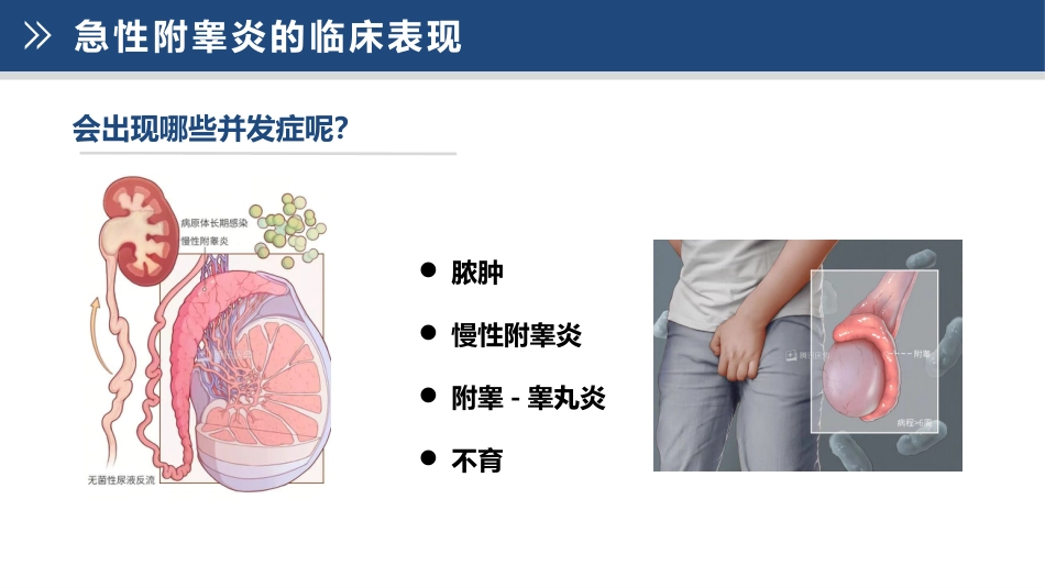 急性附睾炎的护理_第11页