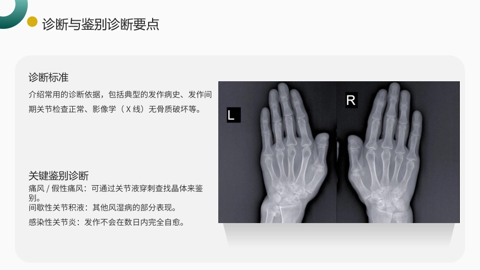 回纹型风湿病护理查房带参考文献_第14页