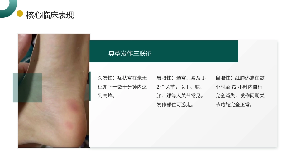回纹型风湿病护理查房带参考文献_第6页