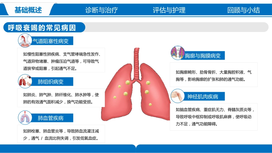 呼吸衰竭的护理_第9页
