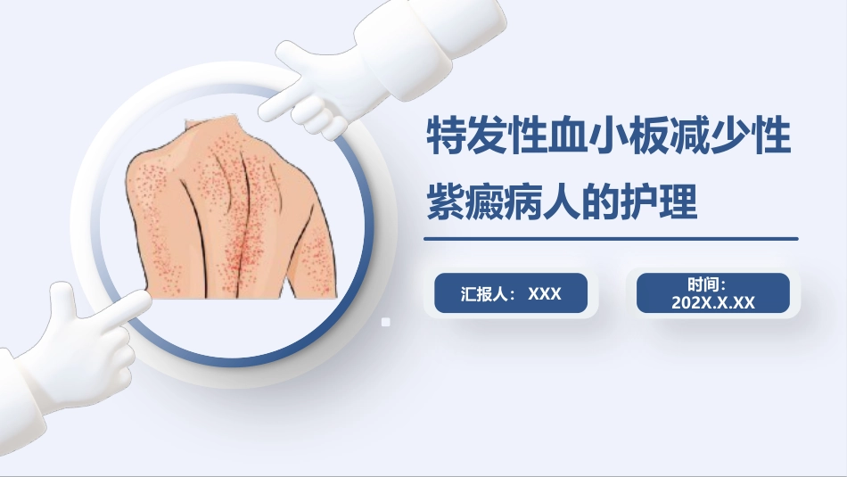 特发性血小板减少性紫癜病人护理汇报_第1页