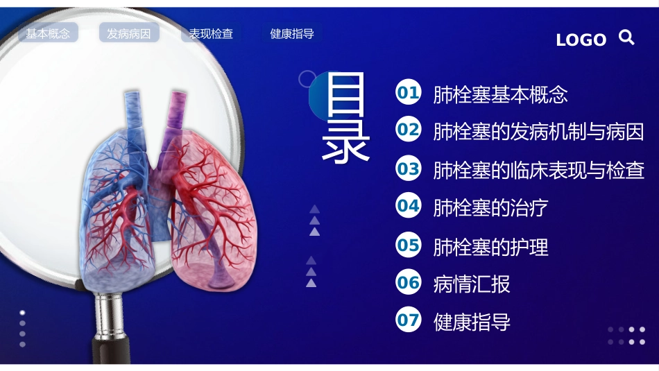 肺栓塞的护理查房_第2页