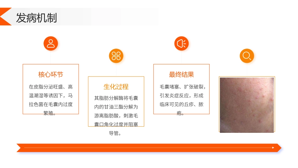 马拉色菌毛囊炎护理查房带参考文献_第5页