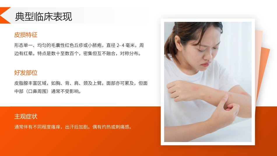 马拉色菌毛囊炎护理查房带参考文献_第8页