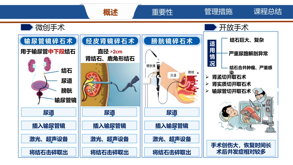 上尿路结石的饮食护理_第11页