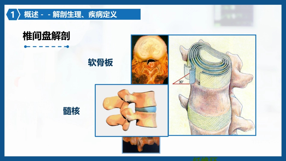 腰椎间盘突出症围手术期护理及康复锻炼1_第5页