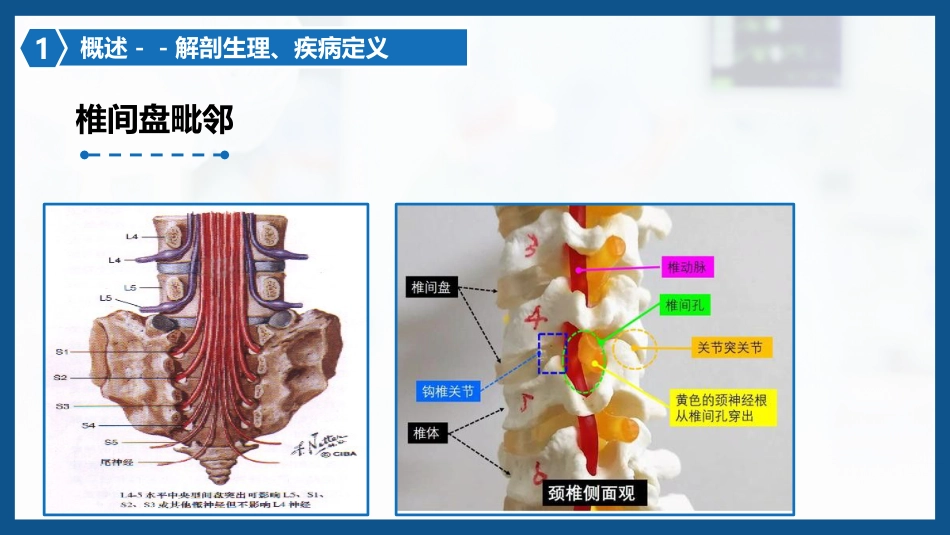 腰椎间盘突出症围手术期护理及康复锻炼1_第6页