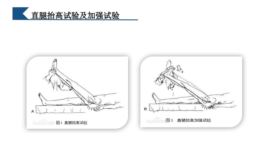 一例腰痛病中医护理教学查房_第10页