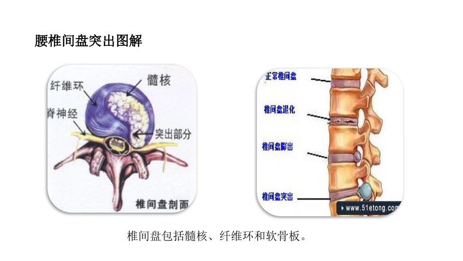 一例腰痛病中医护理教学查房_第6页