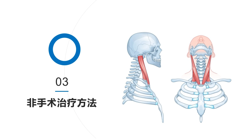 寰枢椎脱位PPT_第12页