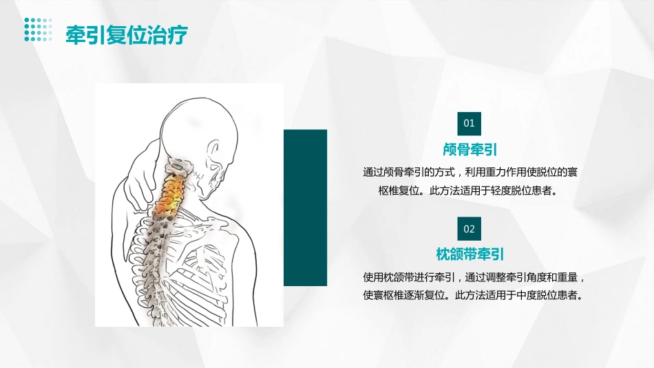 寰枢椎脱位PPT_第13页