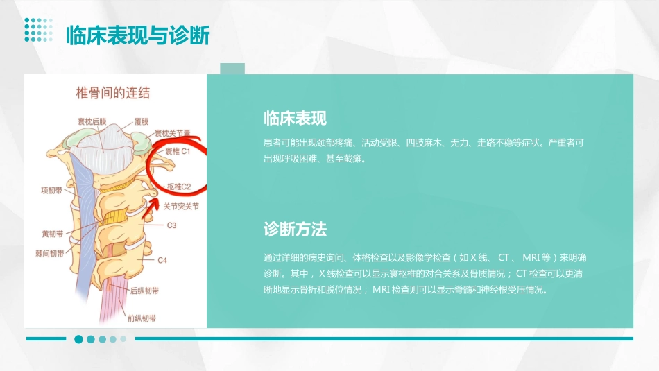 寰枢椎脱位PPT_第6页