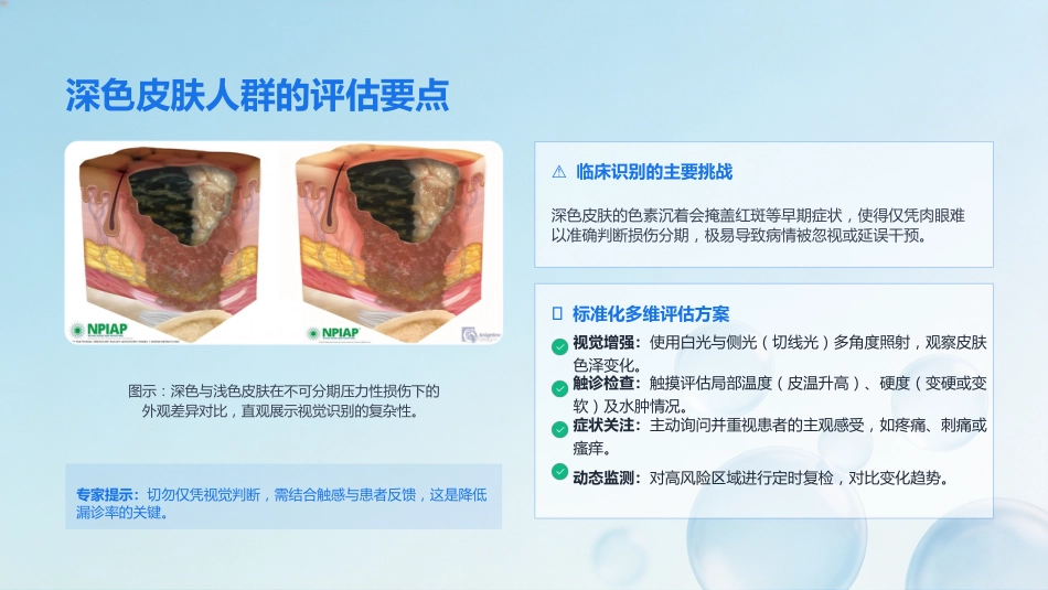压力性损伤的预防与护理(2)(1)_第11页