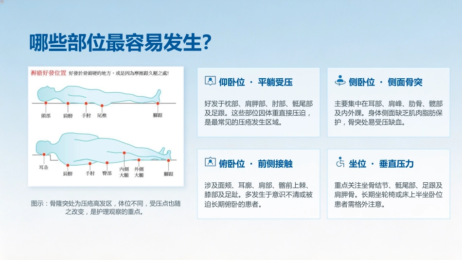 压力性损伤的预防与护理7_第5页