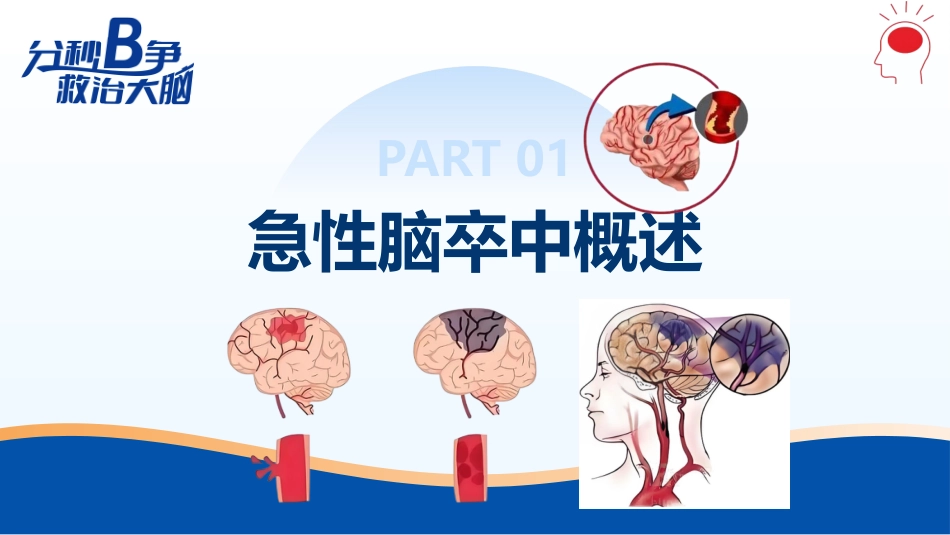 急性脑卒中的急救护理PPT课件_第3页
