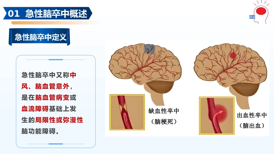 急性脑卒中的急救护理PPT课件_第4页