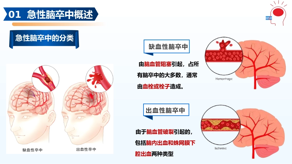 急性脑卒中的急救护理PPT课件_第6页