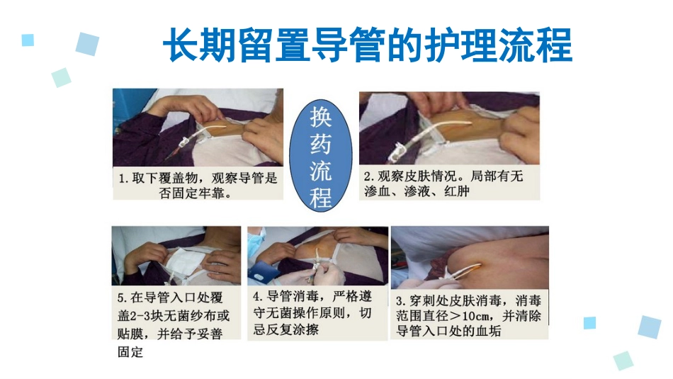 血液透析留置导管护理1_第9页