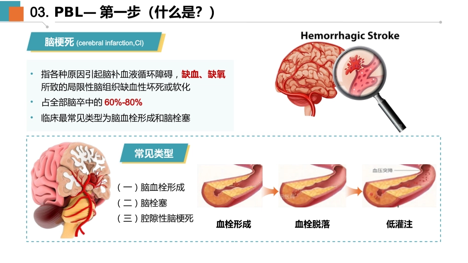 一例脑梗死动脉取栓的PBL教学查房-1_第8页