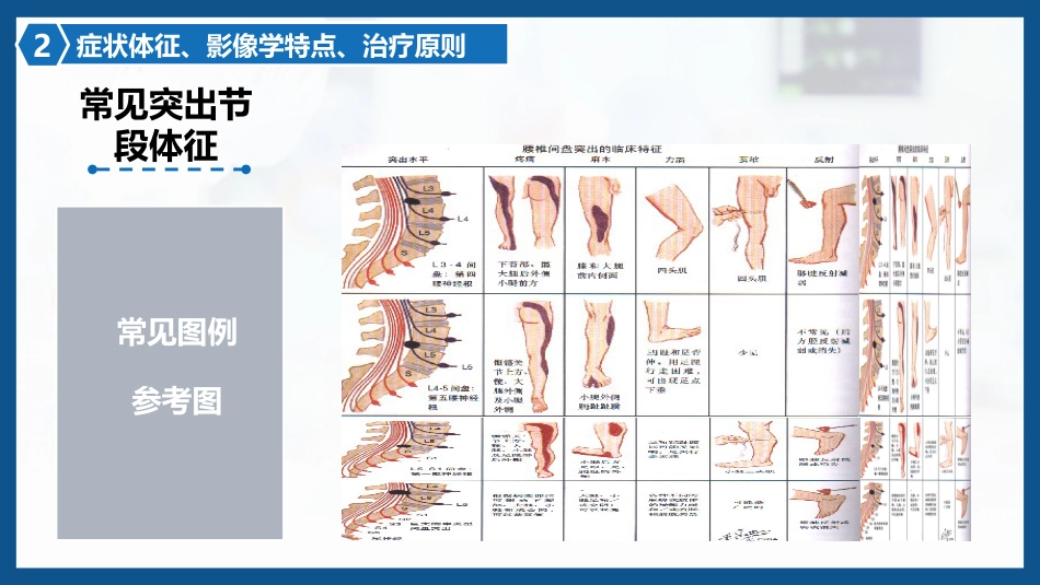 腰椎间盘突出症围手术期护理及康复锻炼1_第14页