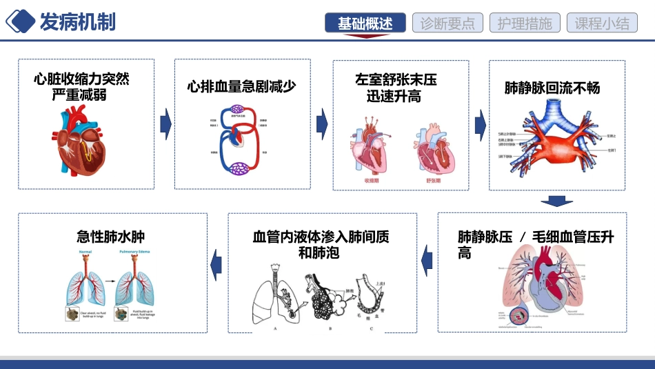 急性心力衰竭的护理讲课-1_第5页