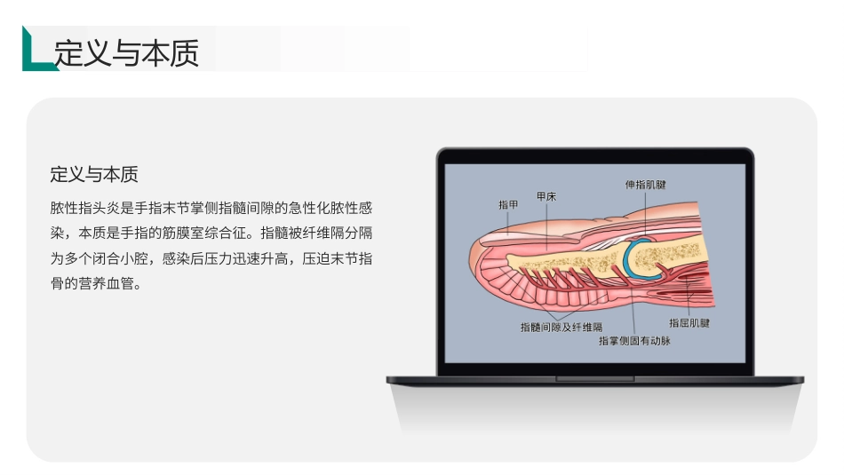 脓性指头炎护理查房带参考文献-1_第4页