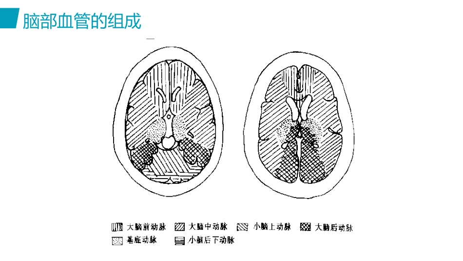 脑出血护理(2)_第9页