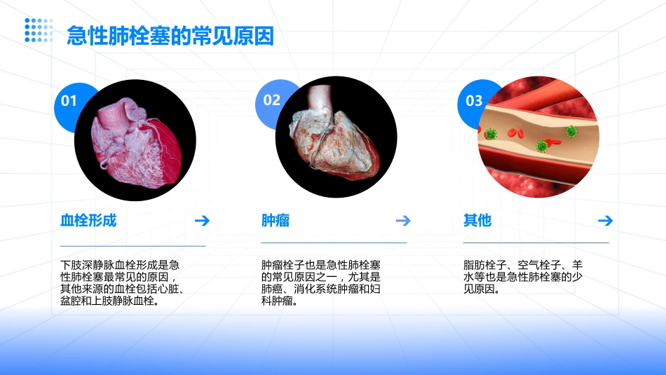 急性肺栓塞的急救处理（2025版）_第5页
