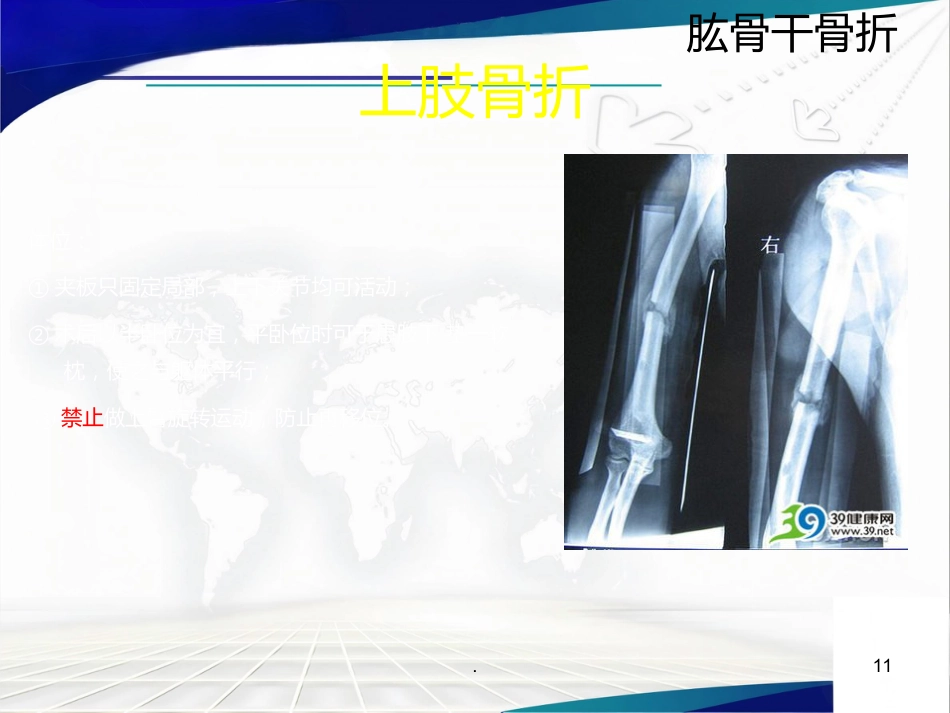骨科 体位护理_第11页