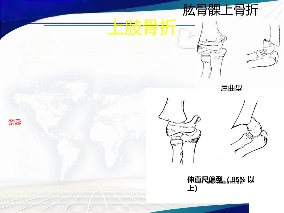 骨科 体位护理_第12页