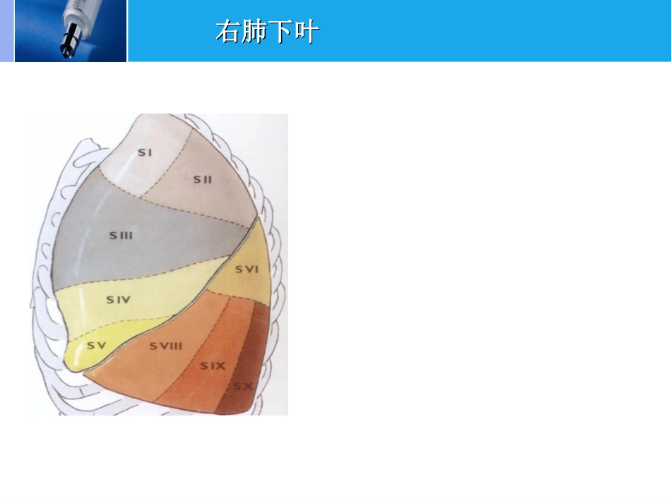 肿瘤科-肺癌-_第10页