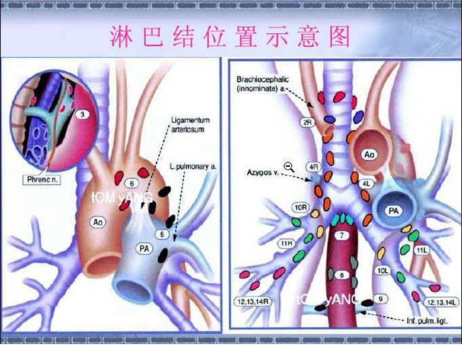 肿瘤科-肺癌-_第12页
